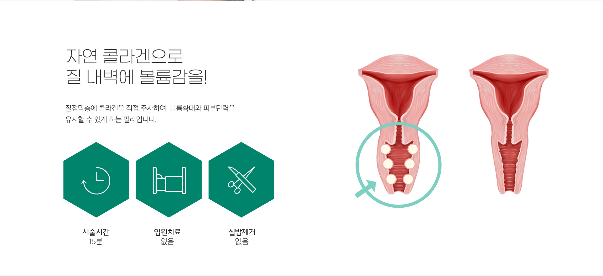 원더필/윙크필8